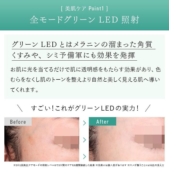 2024年Newモデル》ステラボーテ IPL&LED 光美容器 サントリーニ 2024年Newモデル》ステラボーテ IPL&LED 光美容器 サントリーニ