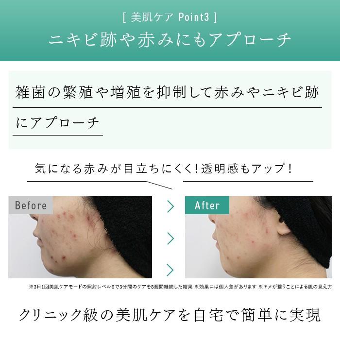 2024年Newモデル》ステラボーテ IPL&LED 光美容器 サントリーニ