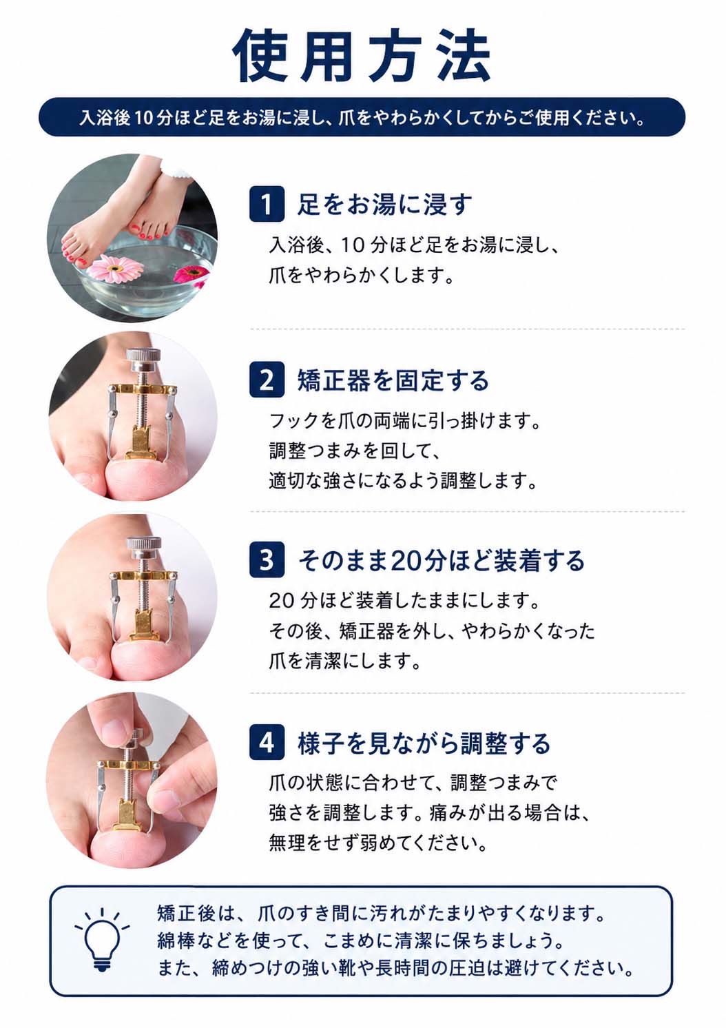 巻き爪リフターF41 巻き爪 矯正器具 まきづめ 矯正 セット まきずめ 陥