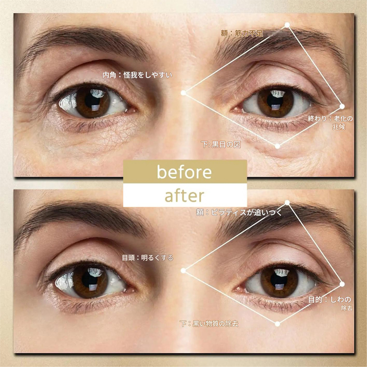 目元美容エステマッサージャー EMS ミールウェーブ有料パッドセット 目元美容エステマッサージャー EMS ミールウェーブ有料パッドセット