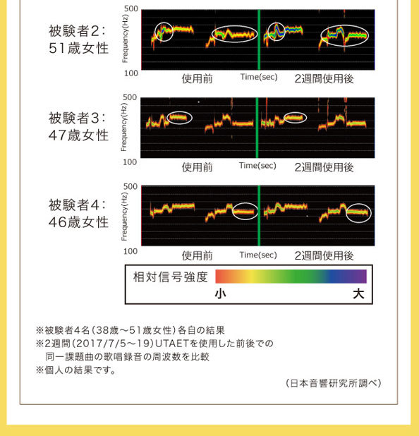 ドリームプロイデアUTAETウタエットボイストレーニング