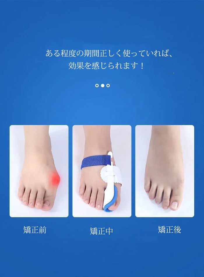 外反母趾 サポーター 矯正 ベルト 夜用 寝る時 親指広げ 固定対策 マジックテープ 装着簡単 足の痛み緩和 親指 フットケア 男 |  | 06