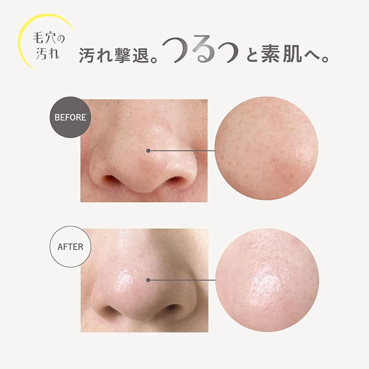 クレンジング ビタミンC MD カプセルスクラブ クレンジングオイル V