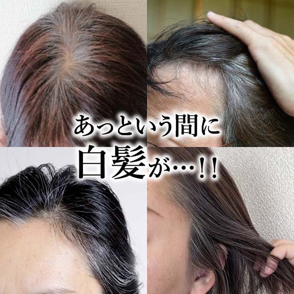 クイックヤング ヘアカラー 白髪染め 生え際 カラーリング 簡単 刷毛タイプ 部分白髪