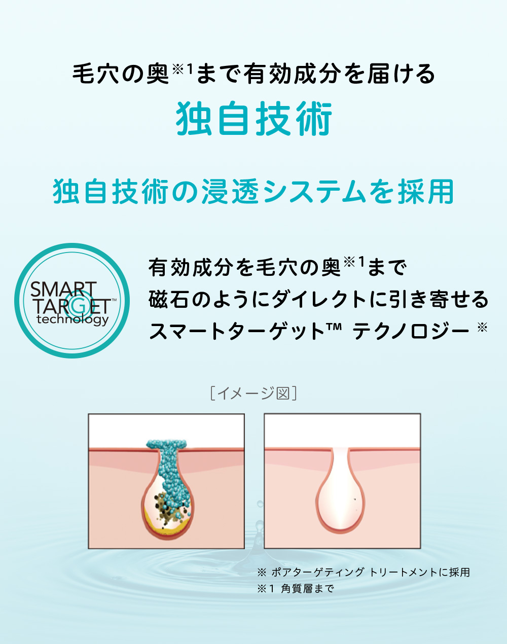 お得☆にきびケア ニキビ跡 スマートセット 90日 サイズ プロ 