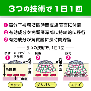Amazon | 【第2類医薬品】ダマリンL 20g | ダマリン | 水虫改善
