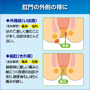 オファー いぼ痔 キャップ