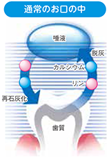 通常のお口の中の状態図