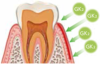 GK2