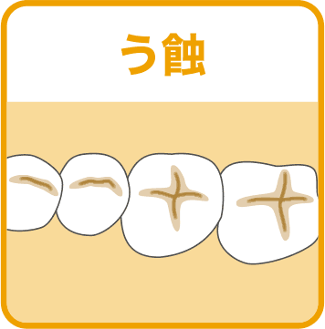 バトラー デンタルペースト特徴2