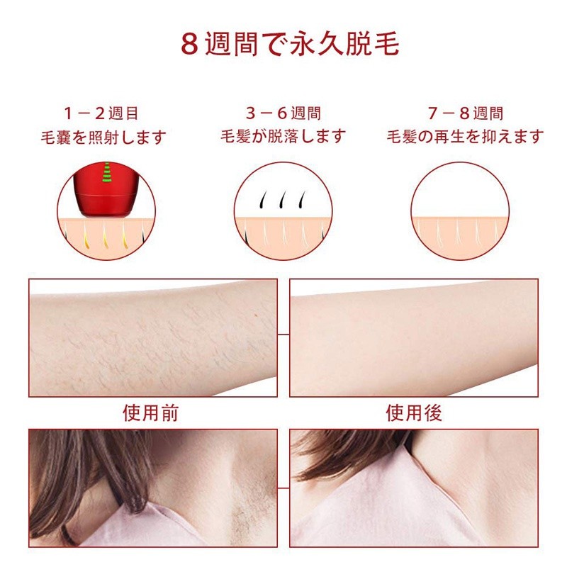 【オンライン限定商品】 美容器 全身 C52 【プロ仕様】VIO対応 冷感脱毛器 光 - その他