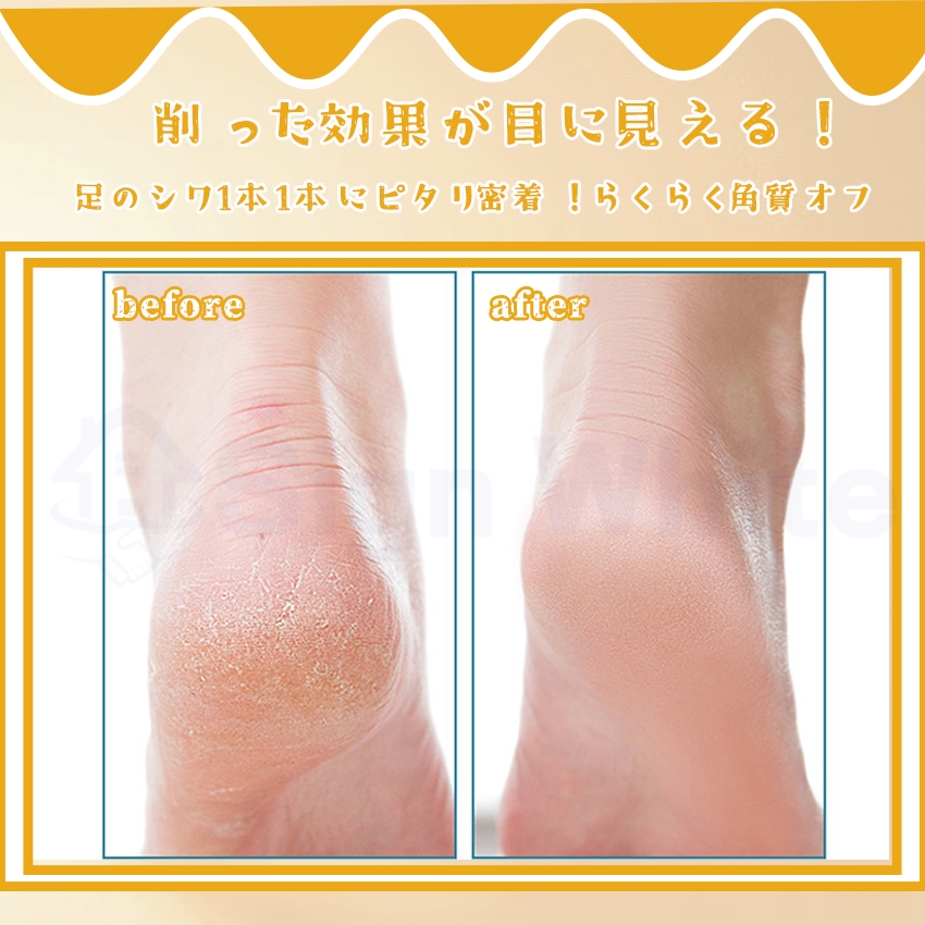 毛剃り こするだけ 無痛 物理 脱毛9