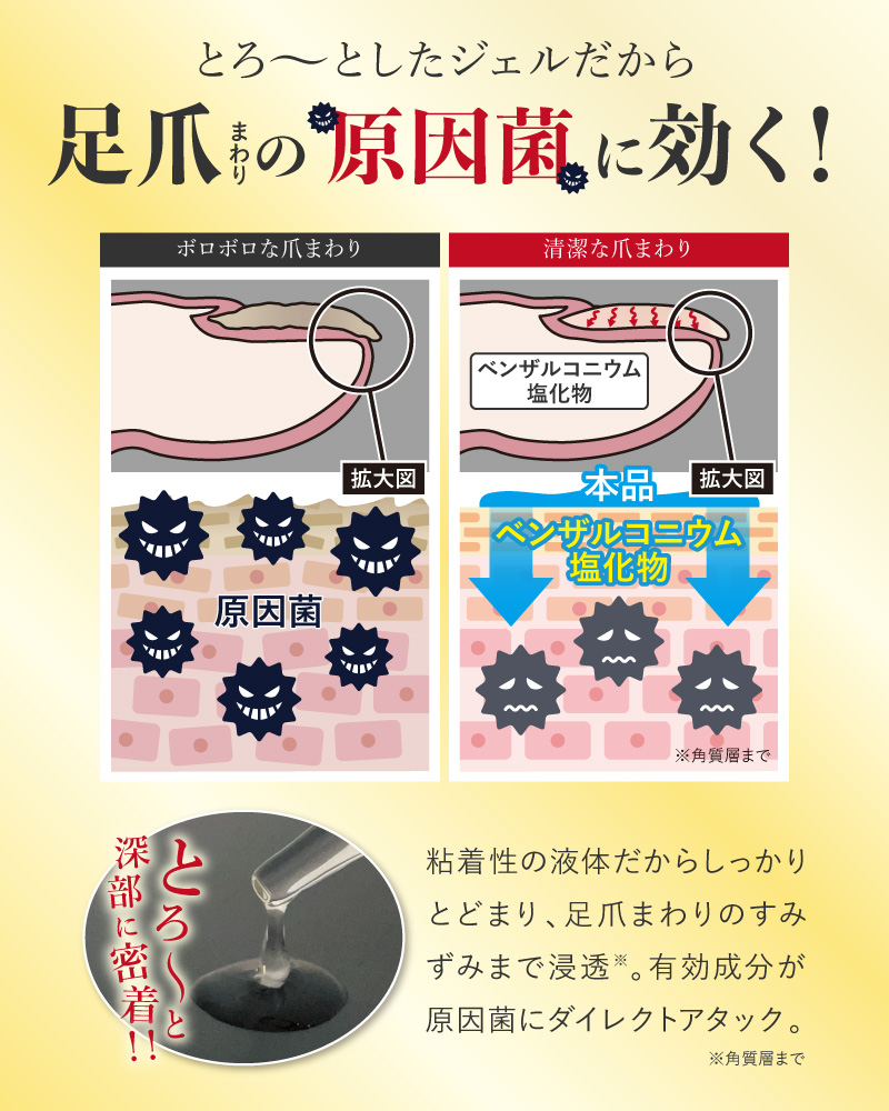 ⭐︎薬用爪ジェル3箱セット⭐︎爪トラブルの方も必見！ ⭐︎薬用爪ジェル3箱セット⭐︎爪トラブルの方も必見！ ⭐︎薬用