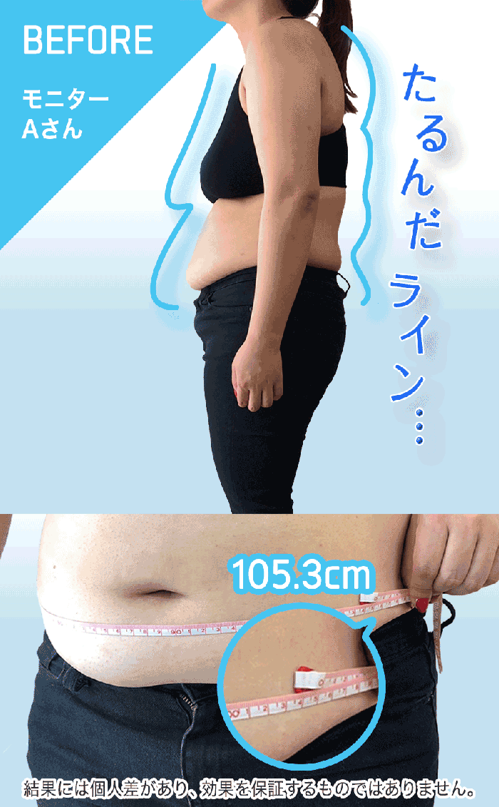骨盤ガードル装着前後の比較