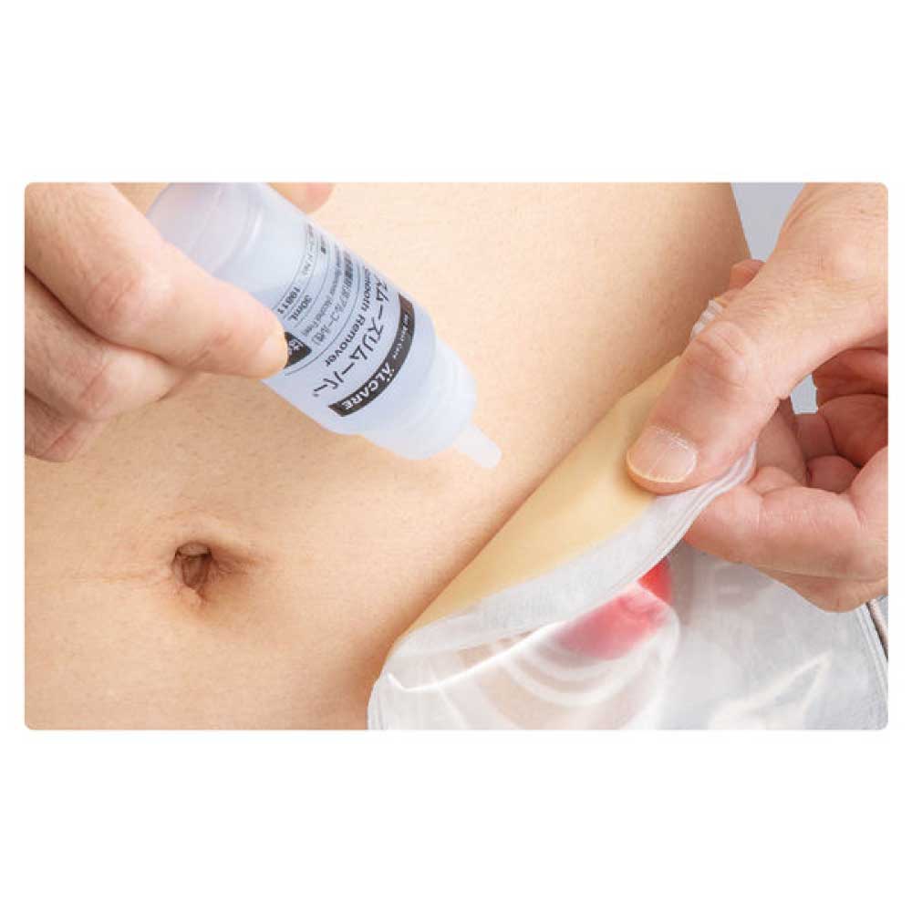 粘着剥離剤 スムーズリムーバー 滴下ボトル 19811 30mL アルケア 非