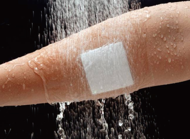 マルチフィックス・ロール 5.0cm×10m 5号 アルケア 透湿 防水性