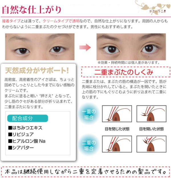 はだいろ工房 アイさぽ 5g 二重 二重まぶた 形成 クセ付け くせづけ