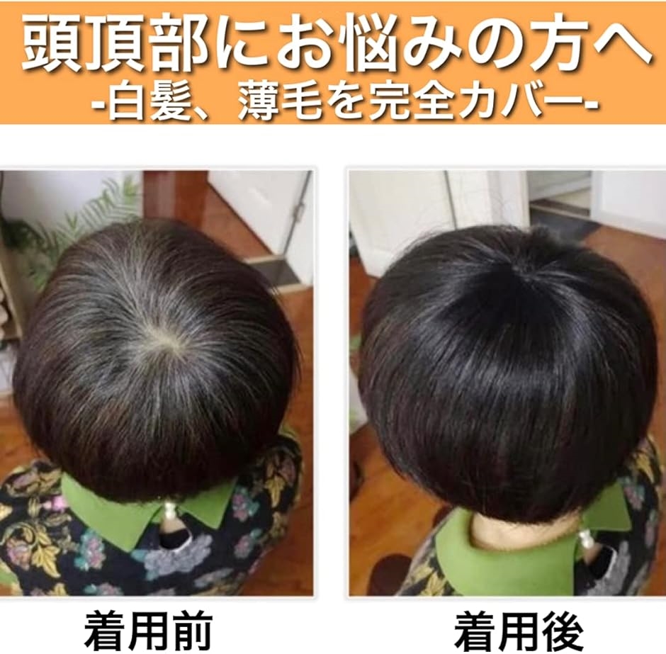 部分ウィッグ ヘアピース かつら 男性 女性 カツラ ウイッグ メンズ レディース 薄毛 MDM( ナチュラルブラック, 1個 (x 1))