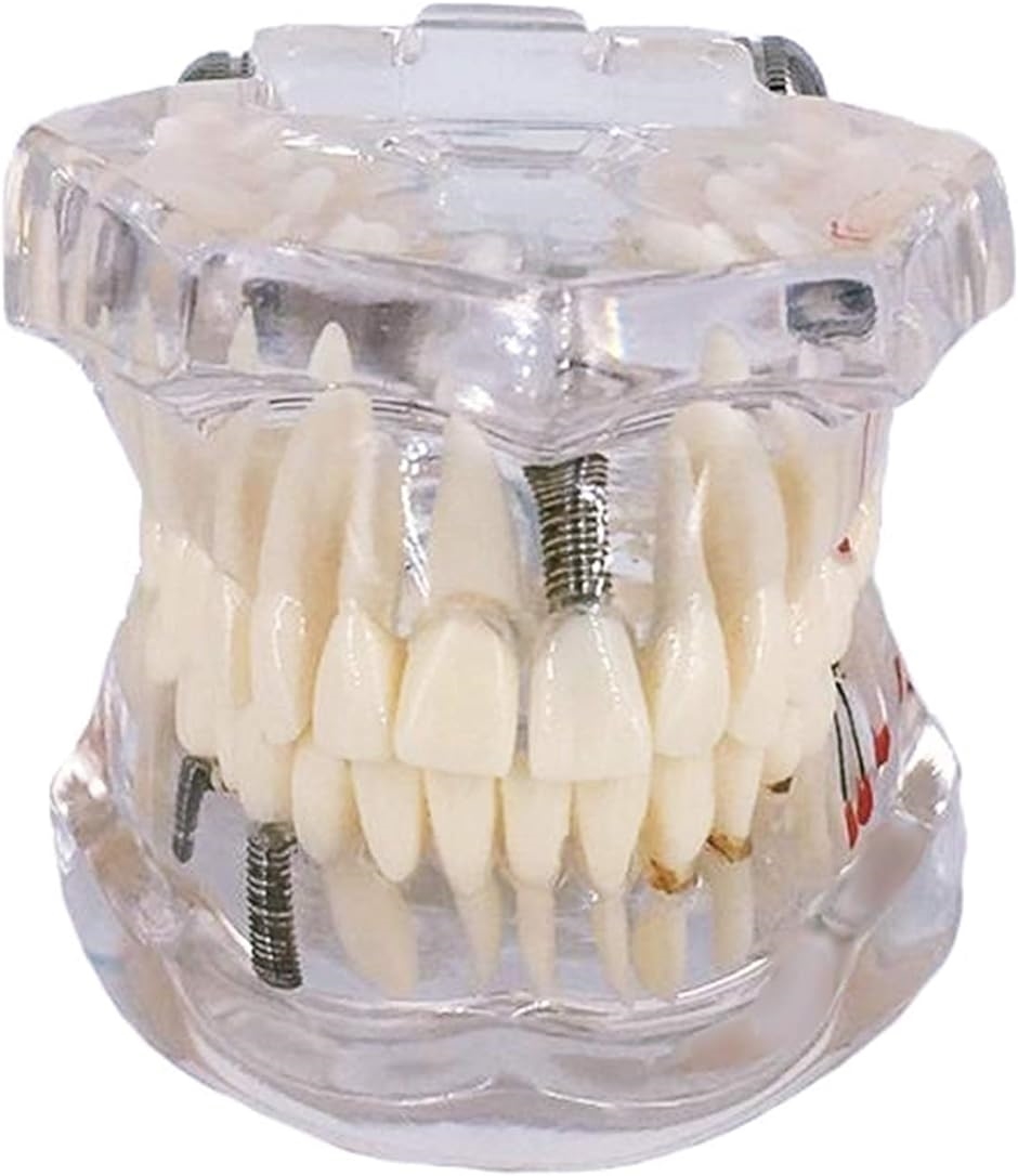 歯科模型 歯列模型 歯医者 研究 説明 教材 学習用( 実物大・透明)