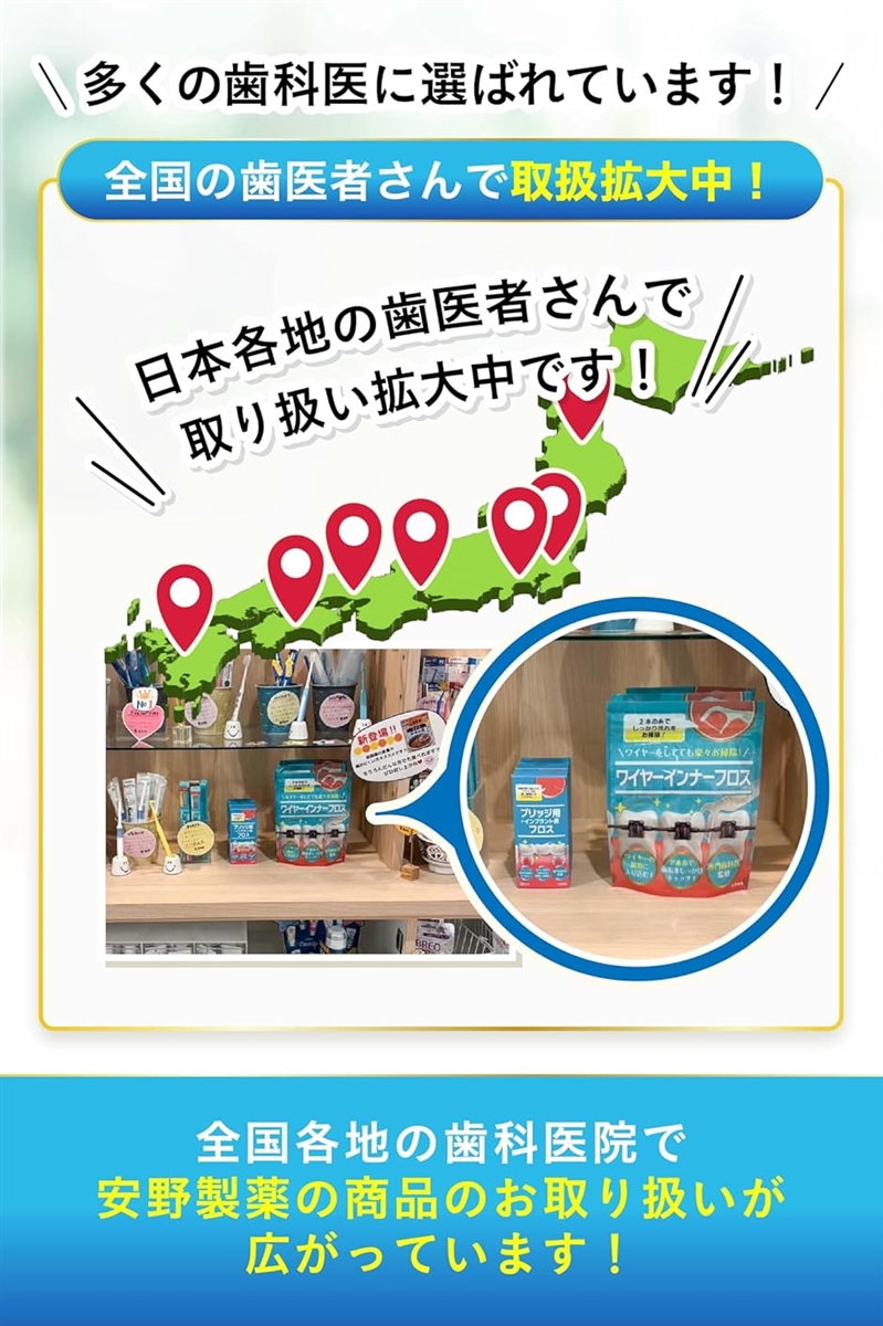 歯医者さんで取扱い中。 矯正用フロス 60本入り歯とワイヤーの間にスルッと入る。(白,  1パック(60本)) | ブランド登録なし | 02