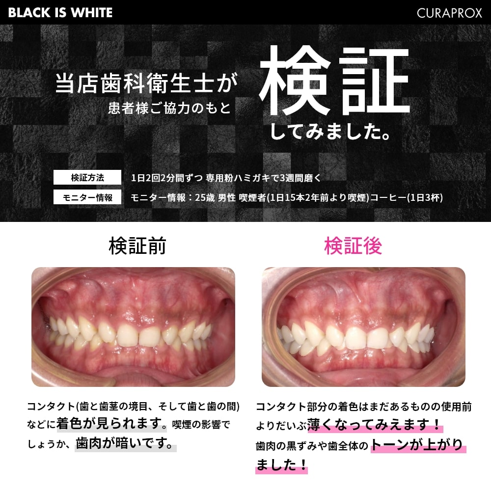 CURAPROX 今なら専用粉はみがき1個付き 音波電動歯ブラシ クラ CURAPROX 今なら専用粉はみがき1個付き 音波電動歯ブラシ クラ
