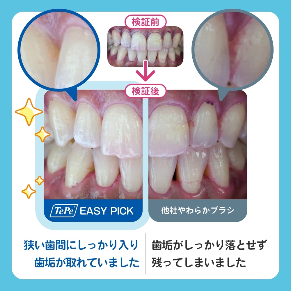 イージーピック