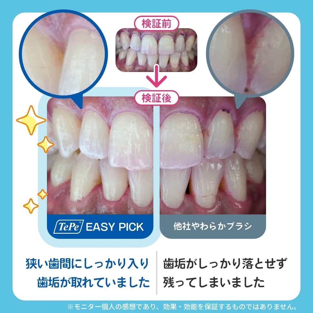 イージーピック