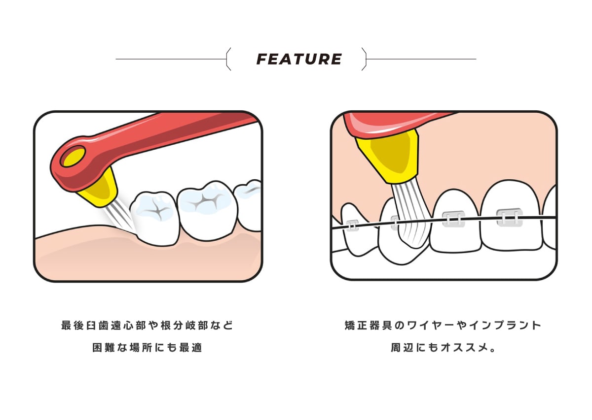 テペヘッドについて