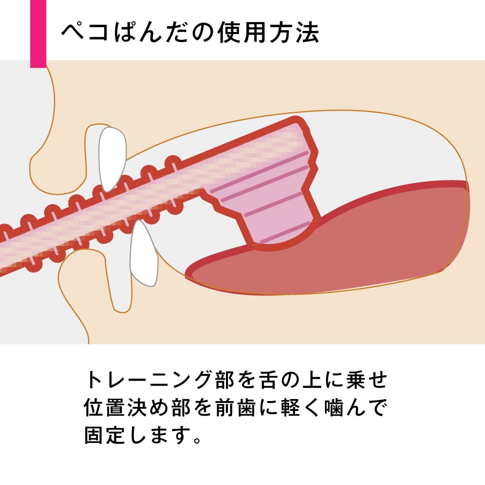 GC