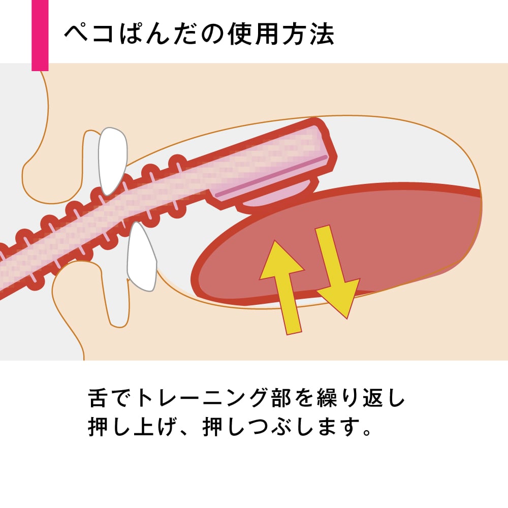 GC