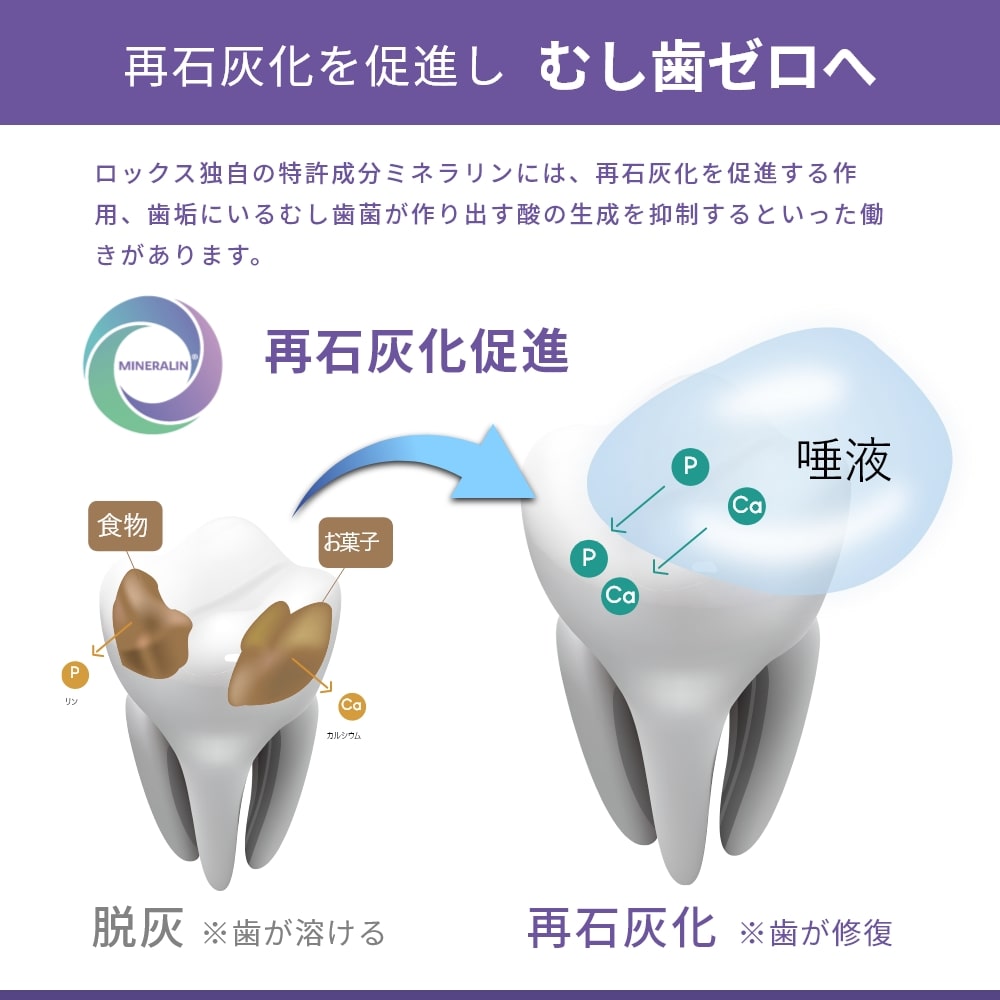 歯磨き粉 ロックスPRO SENSATIONAL WHITE センセーショナルホワイト