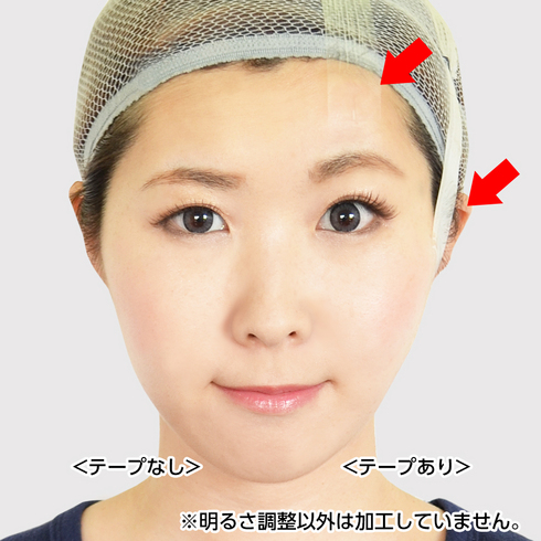 アシストAssist リフトアップテープ 使用方法