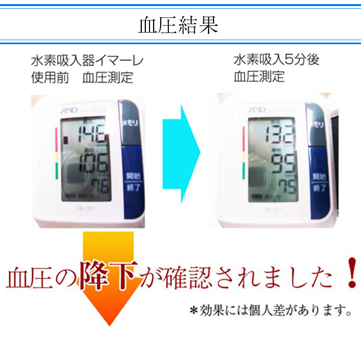 交換用カニューラ 水素吸入 イマーレ専用 : イメージライフ - 通販
