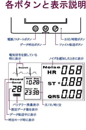 心電図記録機器