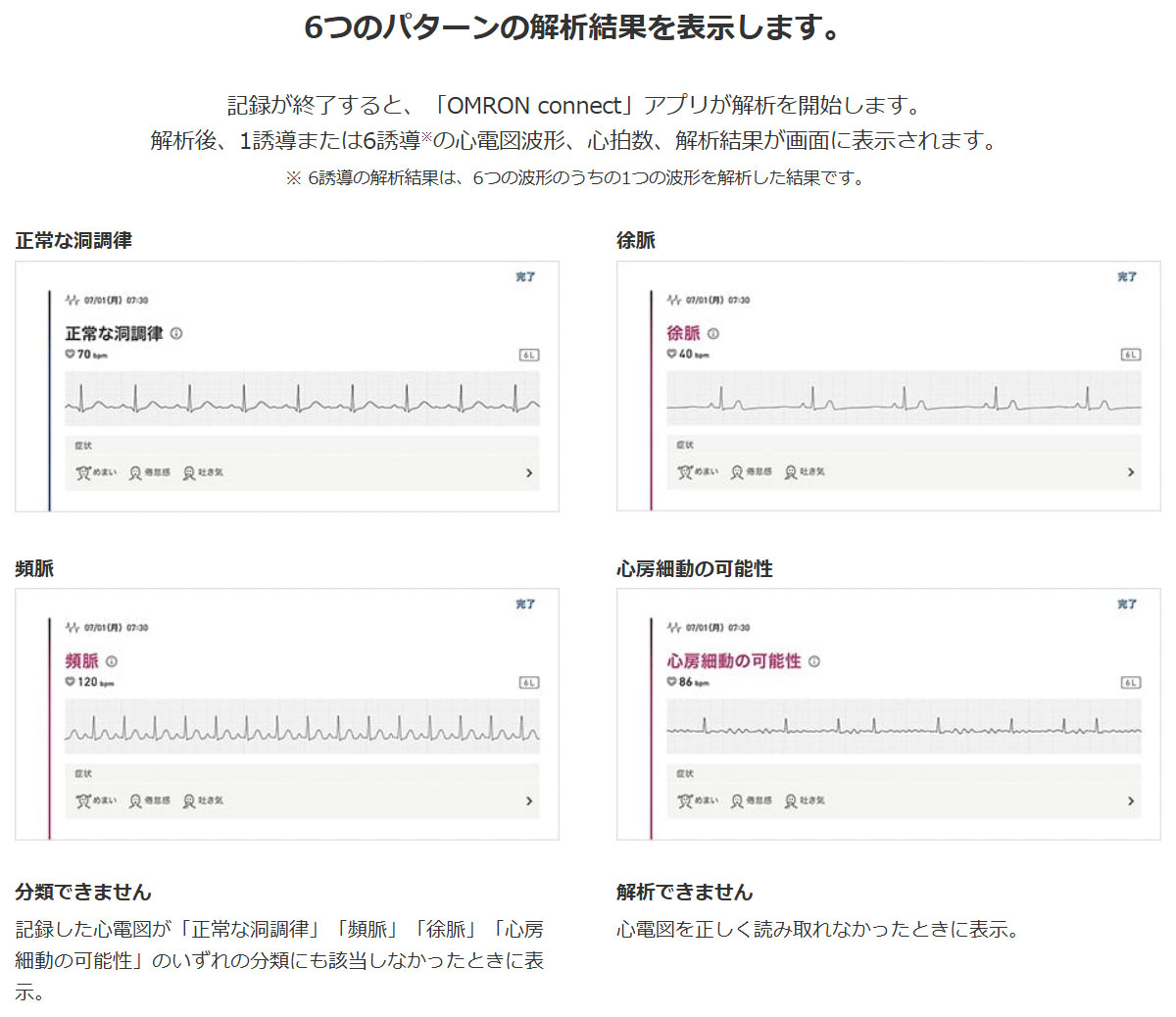 心電図の解析結果イメージ