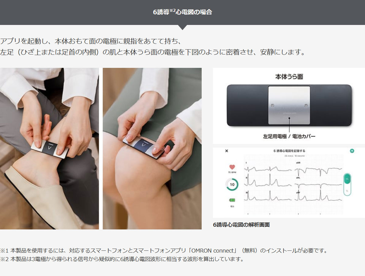 6誘導心電図の測定イメージ