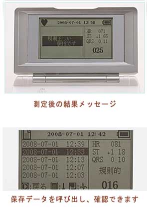 心電図記録機器