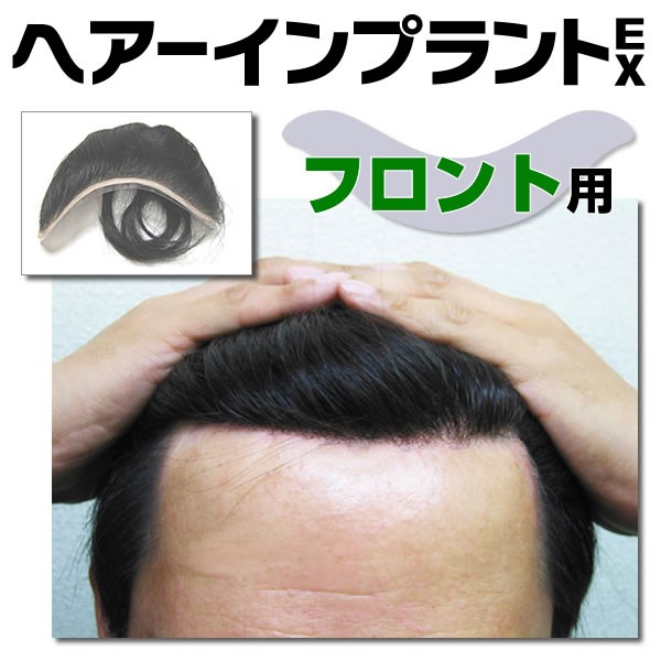 最大93%OFFクーポン メーカー公式ショップ 頭皮一体増毛 ヘアーインプラントEX フロント用 ※装着にはテープかシリコンが必要です rainbow-flower.sakura.ne.jp rainbow-flower.sakura.ne.jp