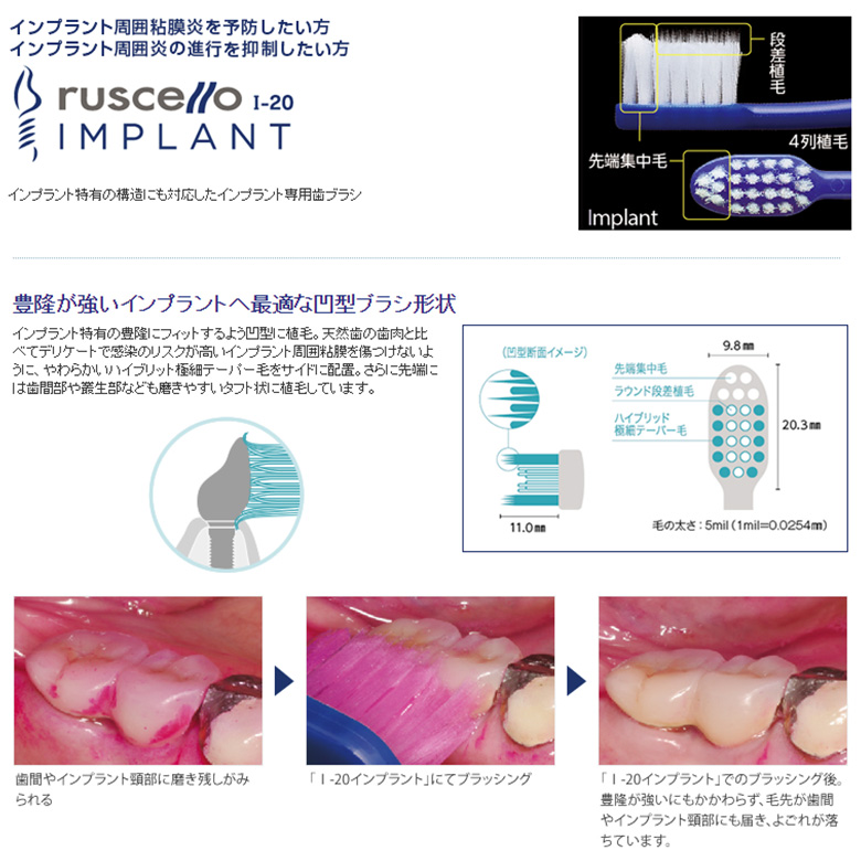 ルシェロ（ジーシー） 歯ブラシ GC ルシェロ I-20 インプラント