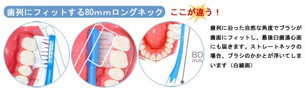 歯列にフィットする80mmロングネック