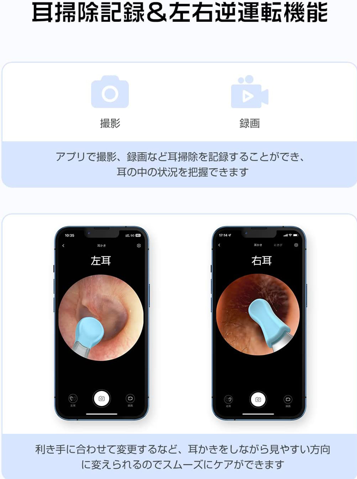 耳かき カメラ LEDライト WIFI ワイヤレス付き iPhone 耳かきスコープ