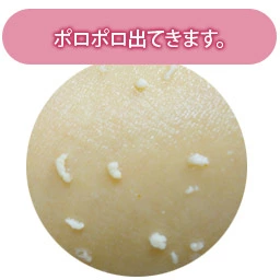 【セット】プレミアムローズピール 300g×2本セット |  | 02