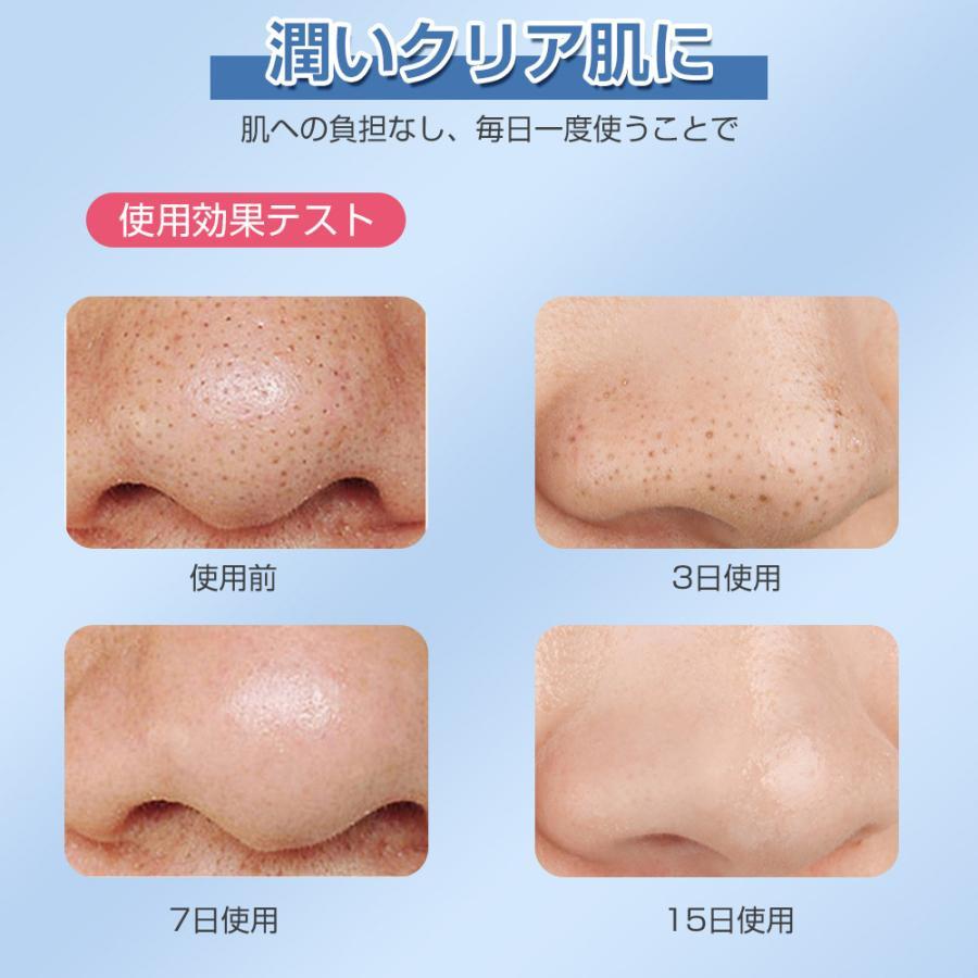 毛穴吸引器 毛穴美顔器 保湿 毛穴ケア 水槽分離水洗浄型 毛穴