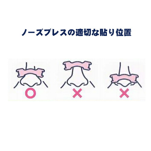 鼻腔拡張テープ 個包装 ノーズブレス (1枚入...の詳細画像2
