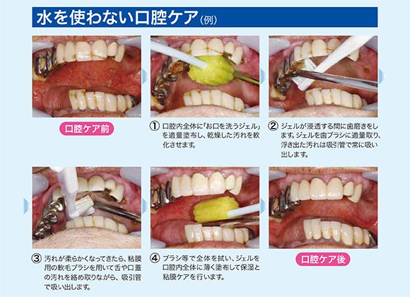 使用例