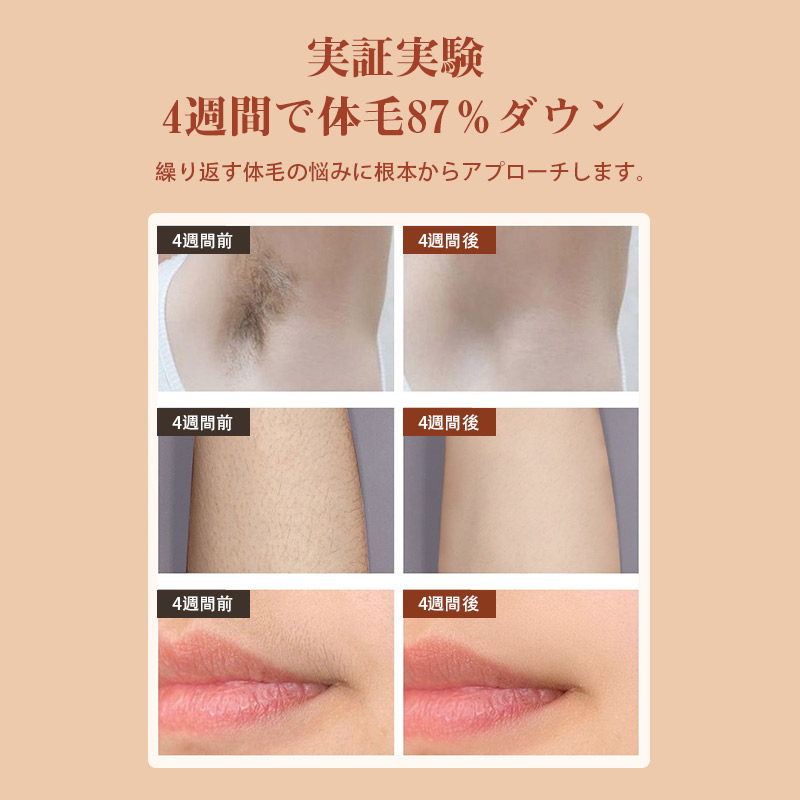 脱毛器 IPL光脱器 永久脱毛 家庭用脱毛器 自動照射 レーザー vio対応