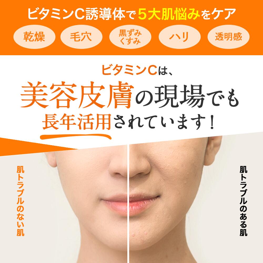GO-VC モイスチャージェル　50g VC ゲル ビタミンC オールインワン ジェル 高浸透型 APPS