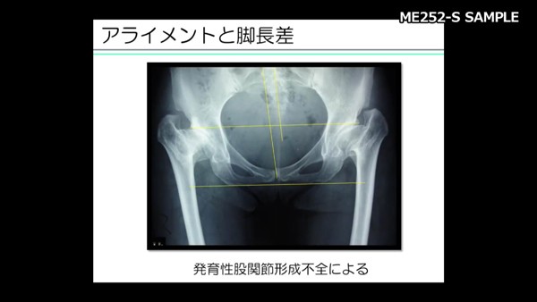 運動器X線画像の見方　ジャパンライム 運動器X線画像の見方 ジャパンライム - メルカリ