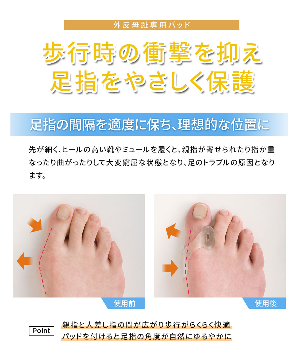 外反母趾 サポーター シリコン 親指 保護 2個入 ジェル パッド 指 痛み 足指 ゲル素材 クッション フットケア 簡単装着 親指ゲルパッド 181 | ニーズ | 01