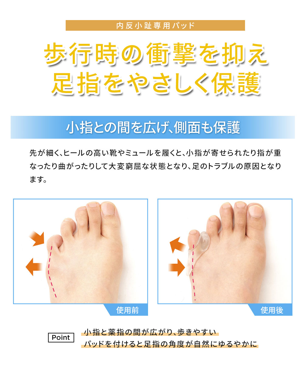 内反小趾 サポーター シリコン 小指 保護 2個入 ジェル パッド 指 痛み ゲル素材 クッション フットケア 簡単装着 小指ゲルパッド 182 爆買 | ニーズ | 01